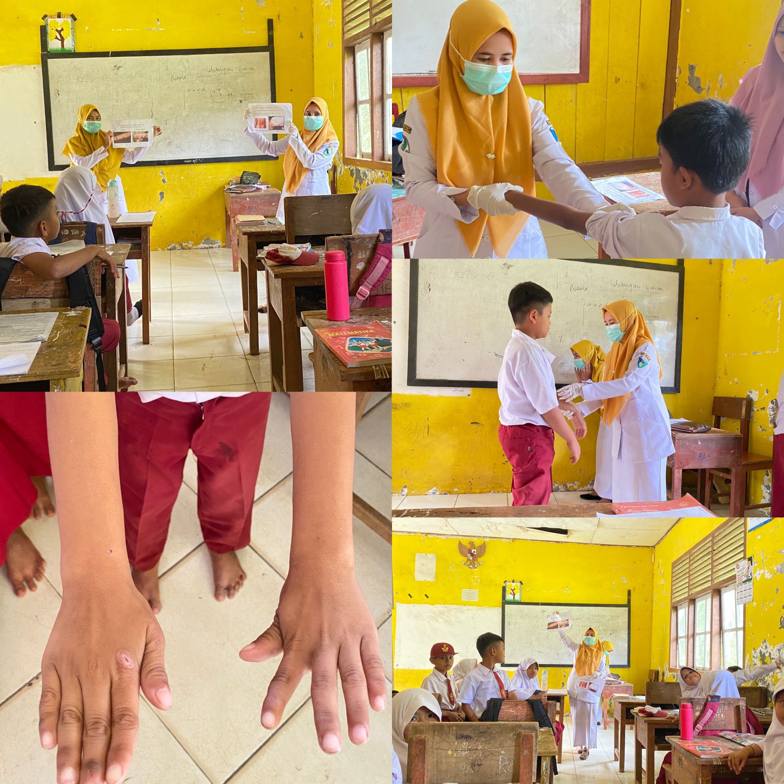  Petugas Puskesmas Tanjung Makmur melakukan penyuluhan dan skrining Penyakit Frambusia dan Kusta pad