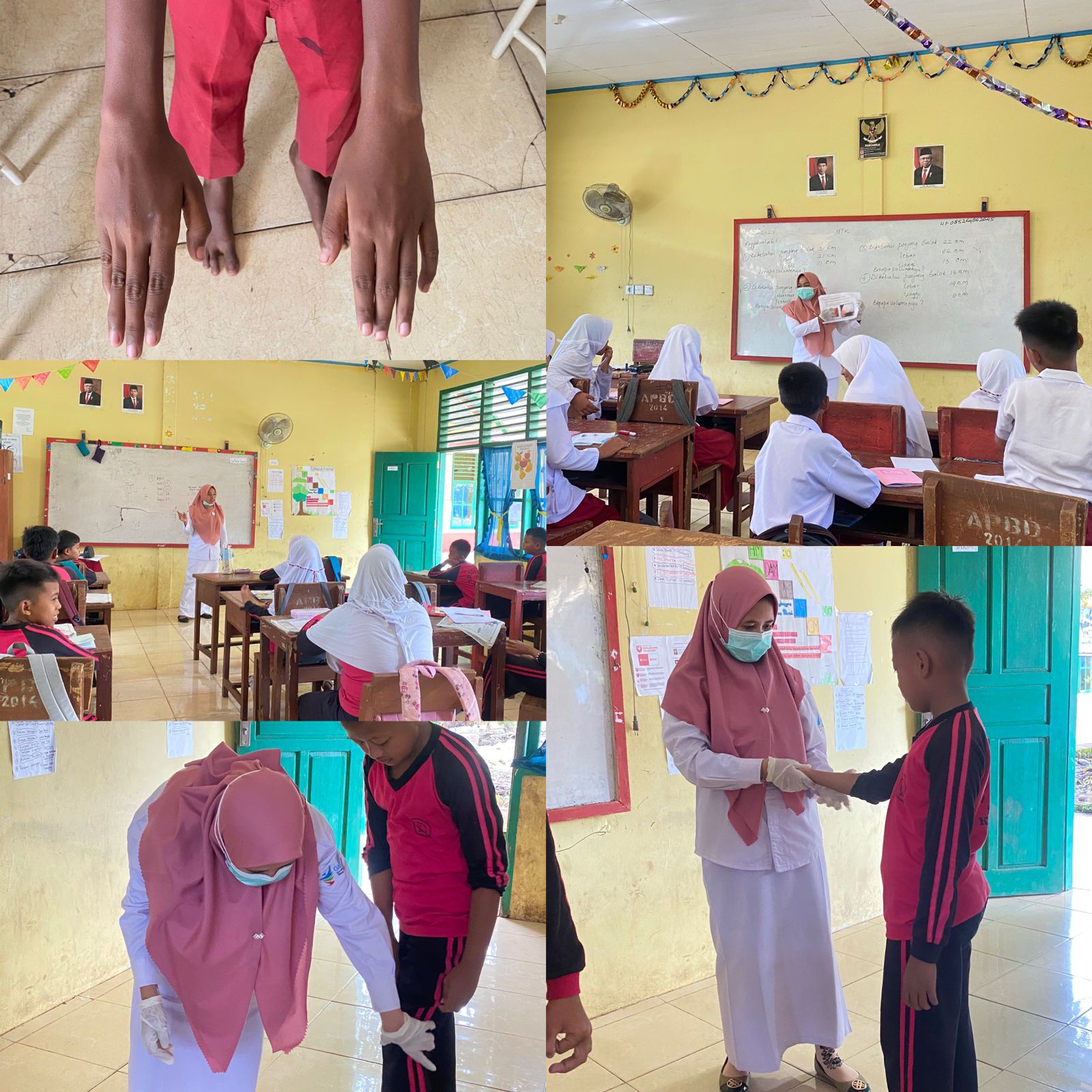 Puskesmas Tanjung Makmur melakukan penyuluhan dan skrining Penyakit Frambusia dan Kusta pada siswa/i