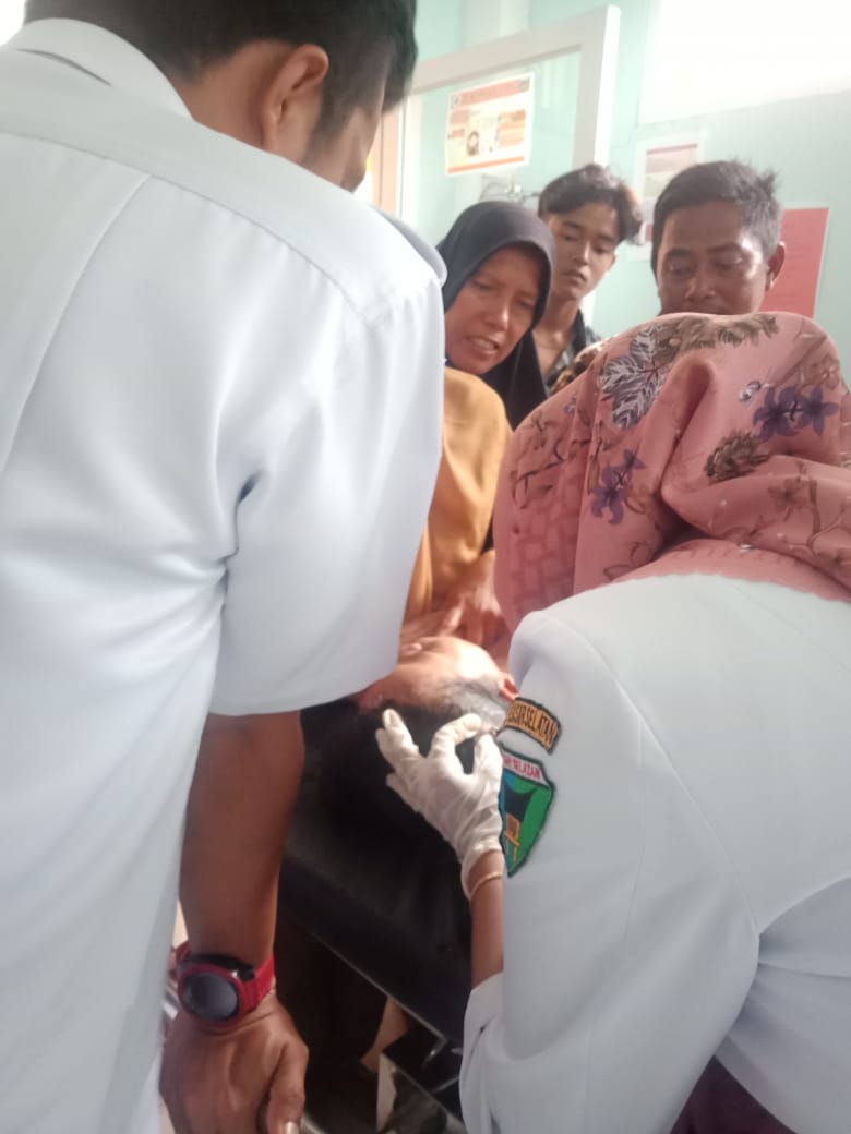 PELAYANAN POLI IGD HARI INI , PENANGANAN PADA PASIEN VULNUS LACERATUM (LUKA ROBEK PUSKESMAS KAYU GAD