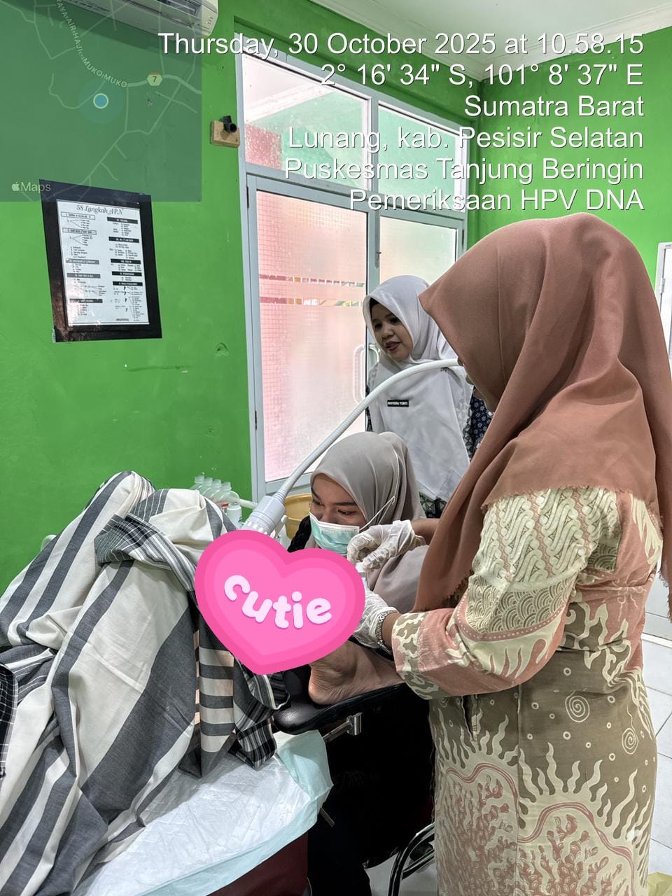 Pemeriksaan HPV DNA Gratis di UPT Puskesmas Tanjung Beringin